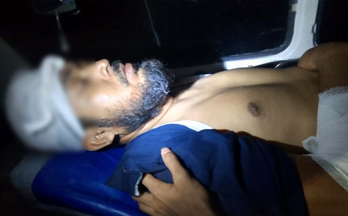 কাপ্তাইয়ে ইউপি সদস্যকে কুপিয়ে গুরুতর জখম, চমেকে রেফার